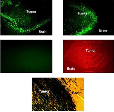 Glioma Cells With Genetically Engineered IGF-I Receptor Downregulation Can Persist in the Brain in a Dormant State